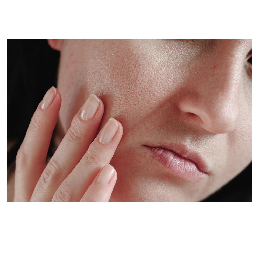 কিভাবে বুঝবেন ত্বকের ধরন জানা আছে কি?